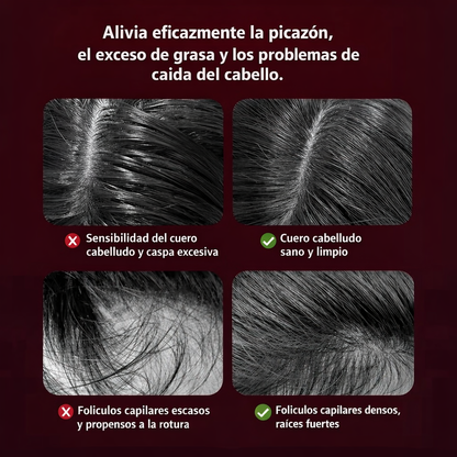 Masajeador de cabello luz led roja
