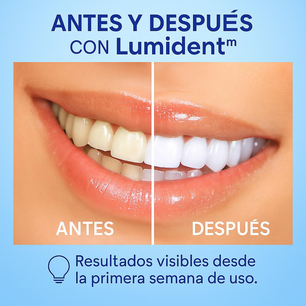 Blanqueador dental-Lumident